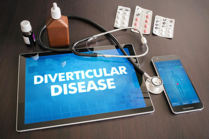 Diverticular Disease